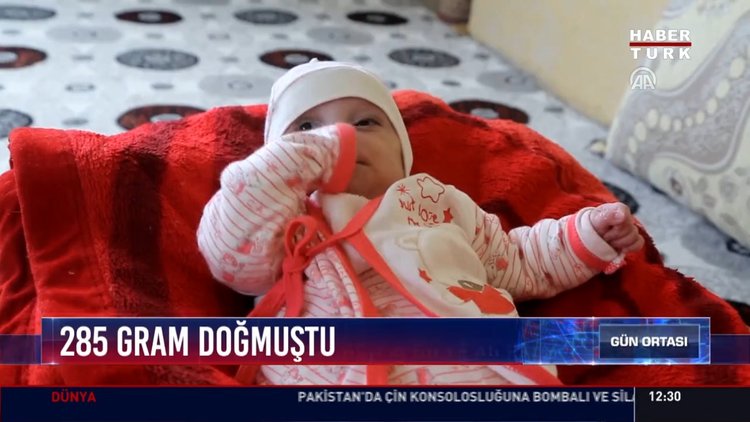 Parmak Bebek Ya Ama Tutundu Gram Olarak D Nyaya Gelen El In Imdi