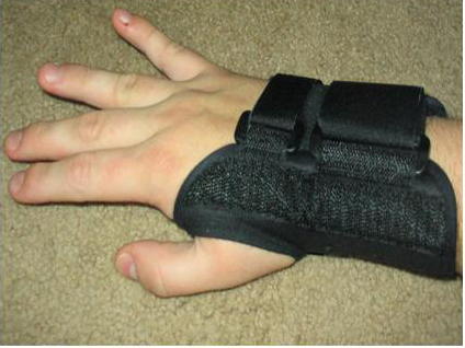 Beyin tümörü neden olur?