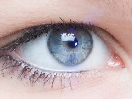 Katarakt ameliyatı basit bir ameliyat mıdır?