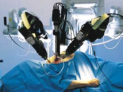 Akciğer kanseri tedavisi robotik cerrahiye mi endeksli?