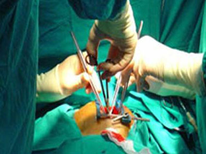 Küçük kesilerle hangi kalp ameliyatları yapılabilir?