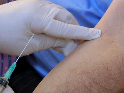 Hepatit A'nın kuluçka dönemi ve seyri nasıl oluyor?