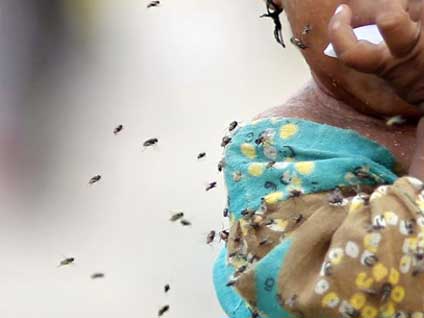 Hepatit A'nın tanısı nasıl konuluyor?