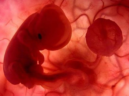 Tüp bebek kimler için son çaredir?