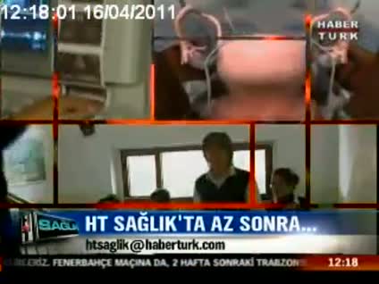 Endometriozise neden çikolata kisti deniliyor?