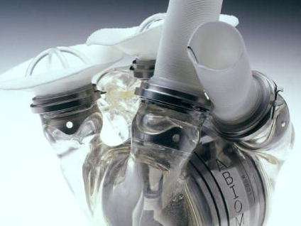 Yapay kalp takılırken hastanın kalbi durduruluyor mu?