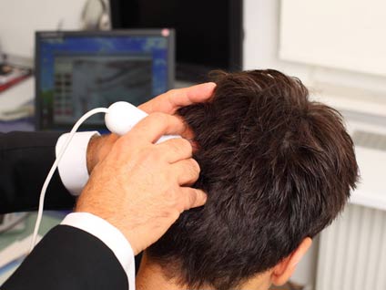 Saç naklinde ön testler var mıdır?