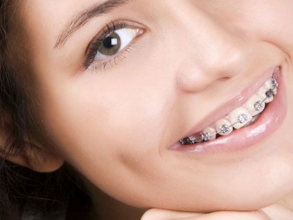 Yetişkinlerin ortodonti  tedavisinde ne tür malzemeler kullanılıyor?