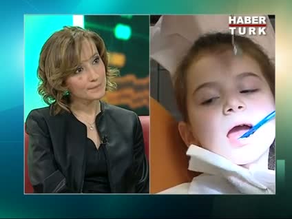 Kopan bir diş nasıl tekrar yerine yerleştiriliyor?