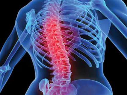 Ankilozan spondilit genetik faktörlerin etkisi var mı? Belirtileri neler?