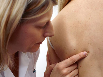 Hangi benler kanser riski taşır?