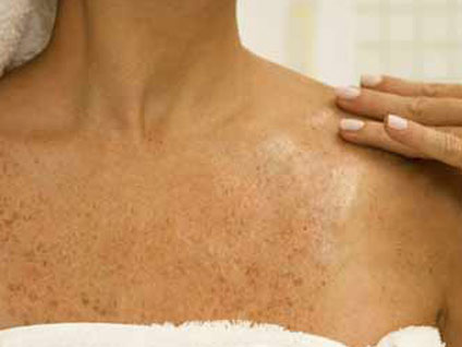 Cilt kanseri kimlerde görülür ve yaş grubu nedir?