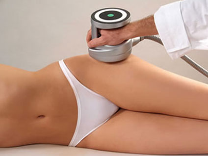 Ultrashape uygulaması için ortalama kaç seans gerekiyor?