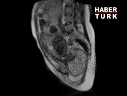 MR'la doğum anı görüntülendi