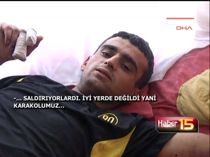 Asıl bugün yaralandı!