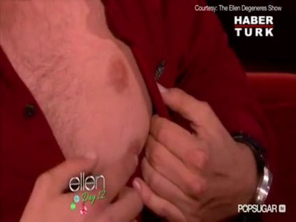 Vücudunda 5 meme ucu var!