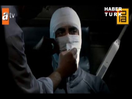 Polat'ın sargıları çıkıyor!