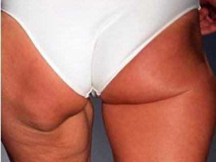 Podyumda şaşırtan görüntü!