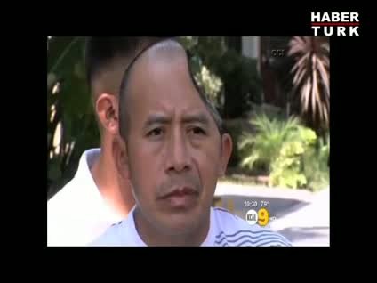 Kafatasının yarısı 58 milyon dolar