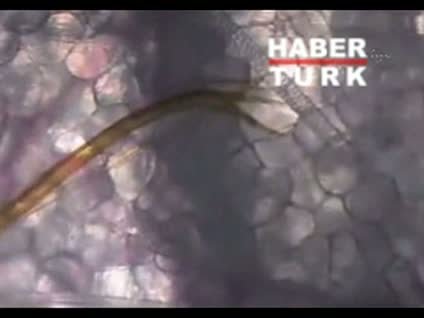 Sivrisineğin damardan kan emmesi ilk kez görüntülendi