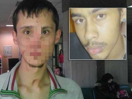 Yüz nakli "ten rengi" uyumsuzluğuna takıldı