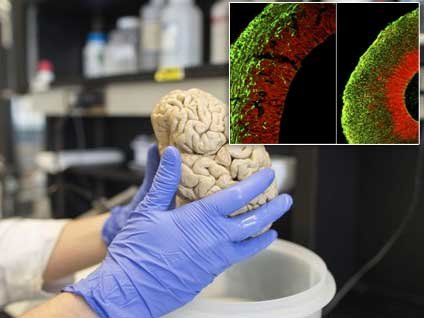 Beyin'de çığır açan keşif