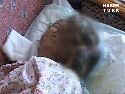 Yüzünde 4,5 kilo taşıyor