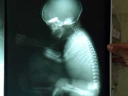 İnsanların kanını donduran şok haber