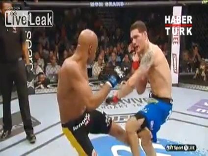 Tekme atarken bacağı böyle kırıldı