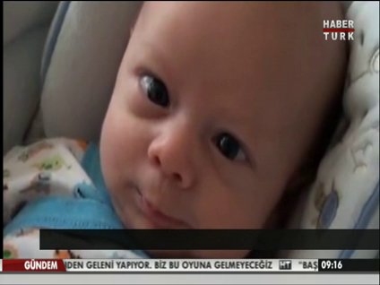 Goze Dokunmadan Lazer Nasil Yapilir