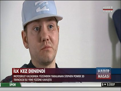 3D teknoloji ile yüz ameliyatı