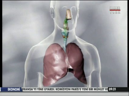 'Süper mikrop' tehdidi!