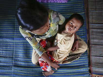 Çocuk felci vakaları artış gösteriyor