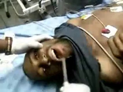 Yanlışlıkla cep telefonu yutmak!