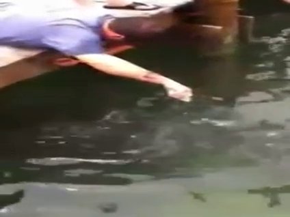 Dev balık adamın kolunu böyle kaptı!