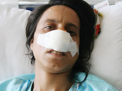 İzmir'de yaşayan Semra Ecerel'e akıl almaz işkence