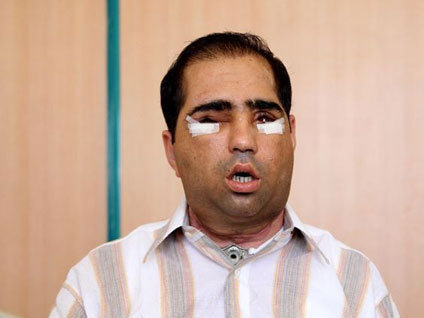 6. yüz naklinden acı haber!