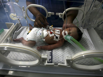 Gazze'nin mucize bebeği