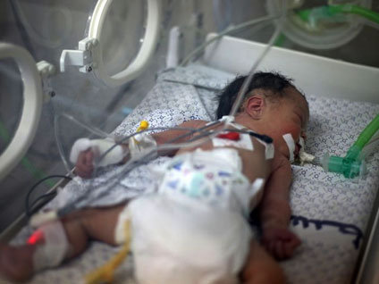 Minik Şeyma hayata tutunamadı