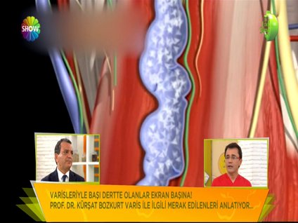 Varis neden daha çok kadınlarda görülür?