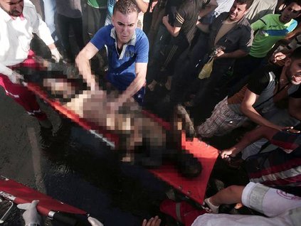 Yaralı Filistinliler