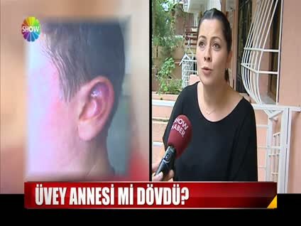 XL mankenden dayak iddiası!