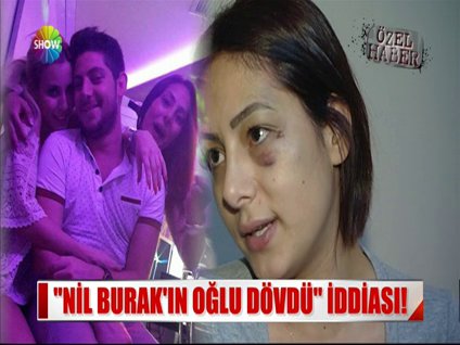 "Nil Burak'ın oğlu dövdü" iddiası!
