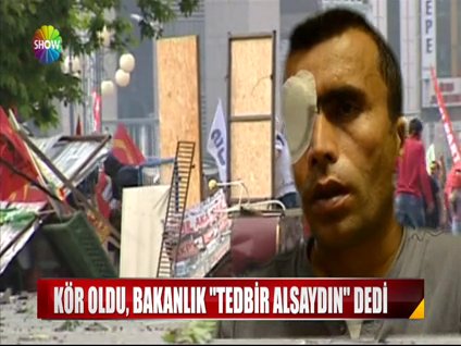 Kör oldu, Bakanlık "Tedbir alsaydın" dedi