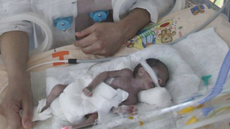 Parmak bebeğin savaşı