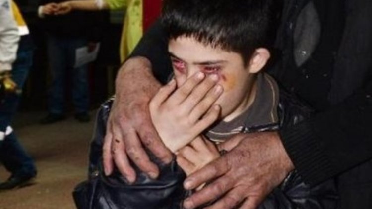 Down sendromlu çocuk bu hale nasıl geldi?