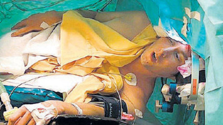 Ameliyat sırasında hayatının şarkısını söyledi