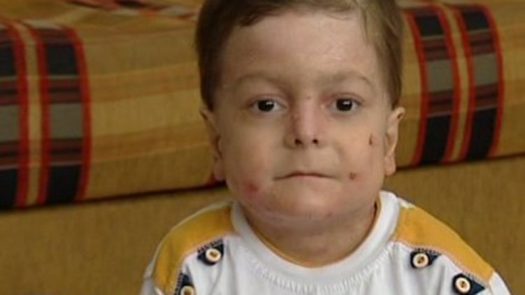 "Kelebek çocuk" Muhammed yardımlarınızı bekliyor