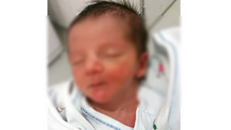 Soluk borusuna mendil kaçan 1 aylık bebek öldü