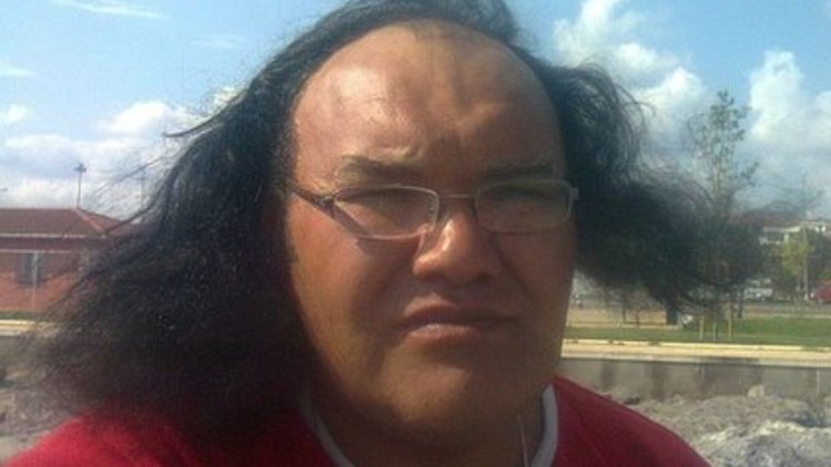 Polis diş izini sürerek cinayeti aydınlattı